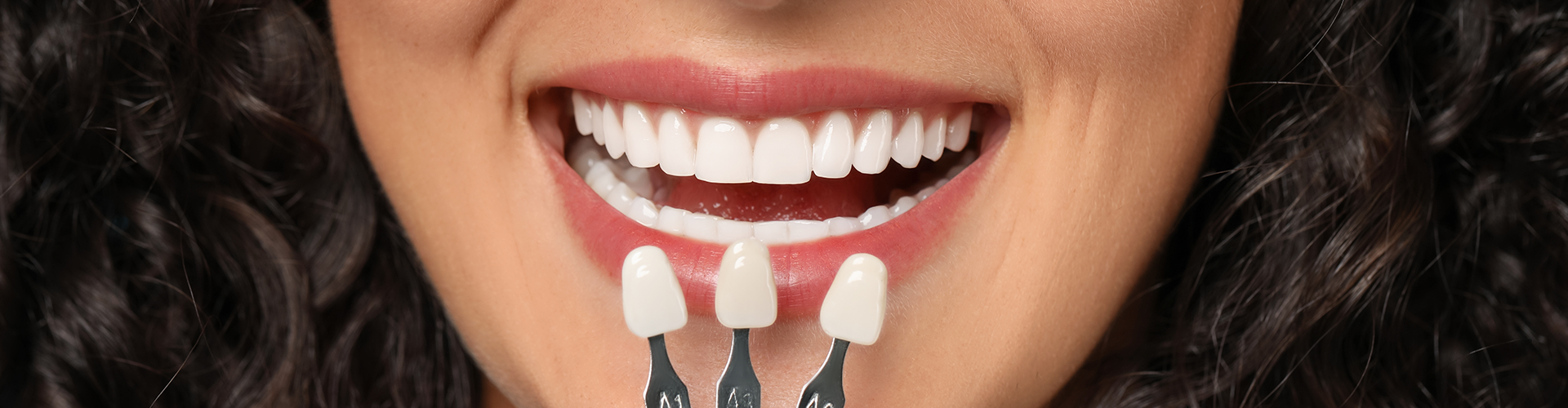 gloved hand holding shade-matching tool against woman's teeth